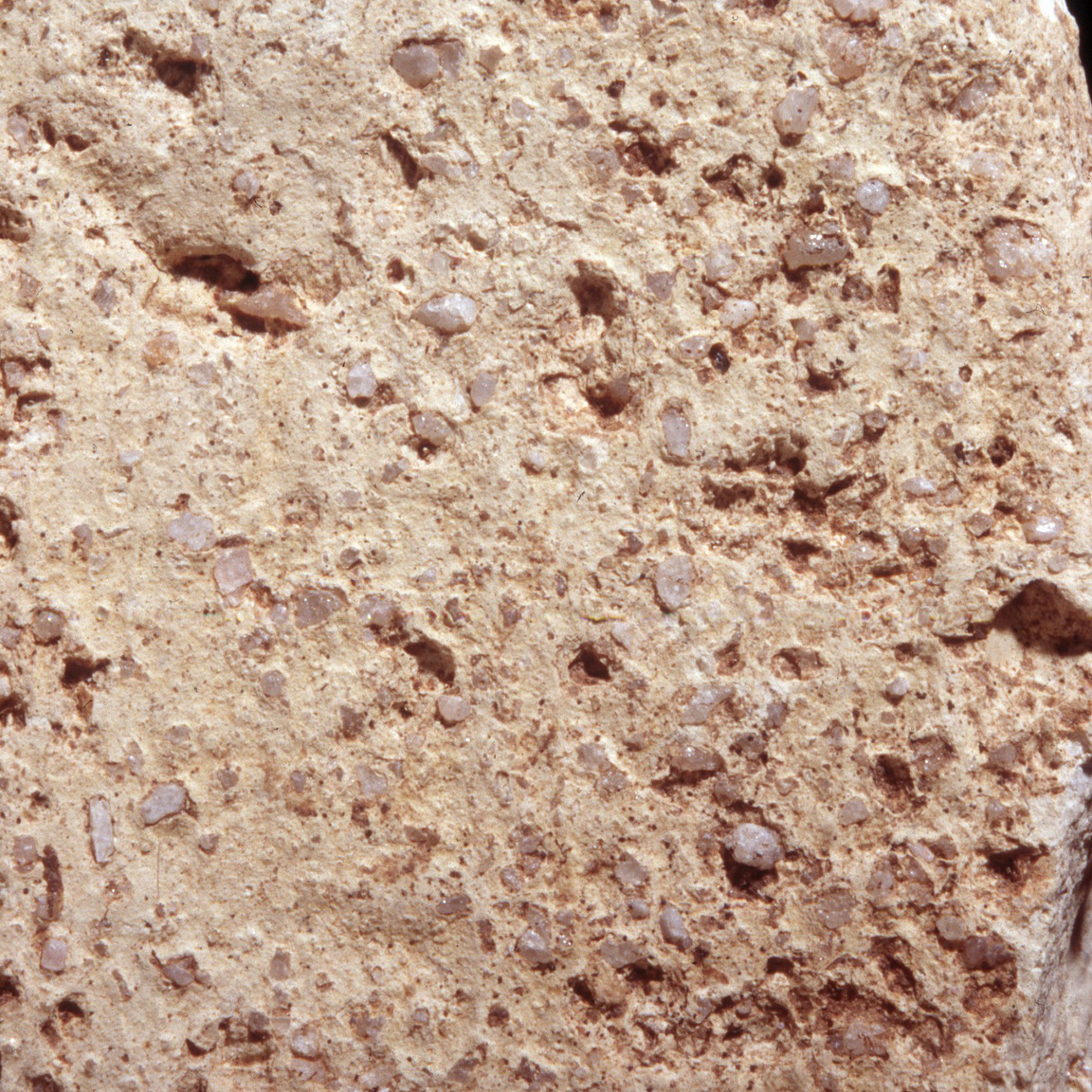 Plate 57b: Trituration grits on RHL WH (width of field 24 mm)